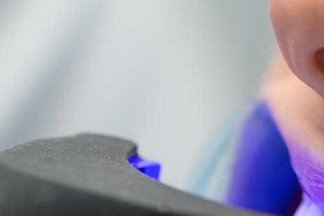 종로치과 치아미백 밝고 환하게 관련 이미지 8