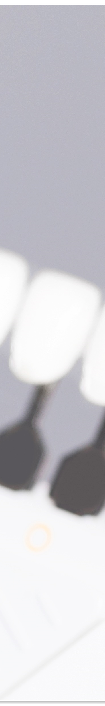 종로치과에서 알려드리는 치아미백과 라미네이트의 모든 것 관련 이미지 31