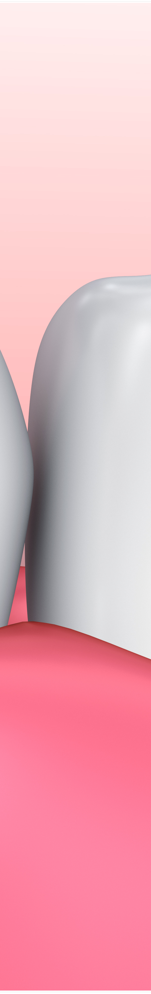 명동치과 라미네이트로 환하게 스마일~ 관련 이미지 27