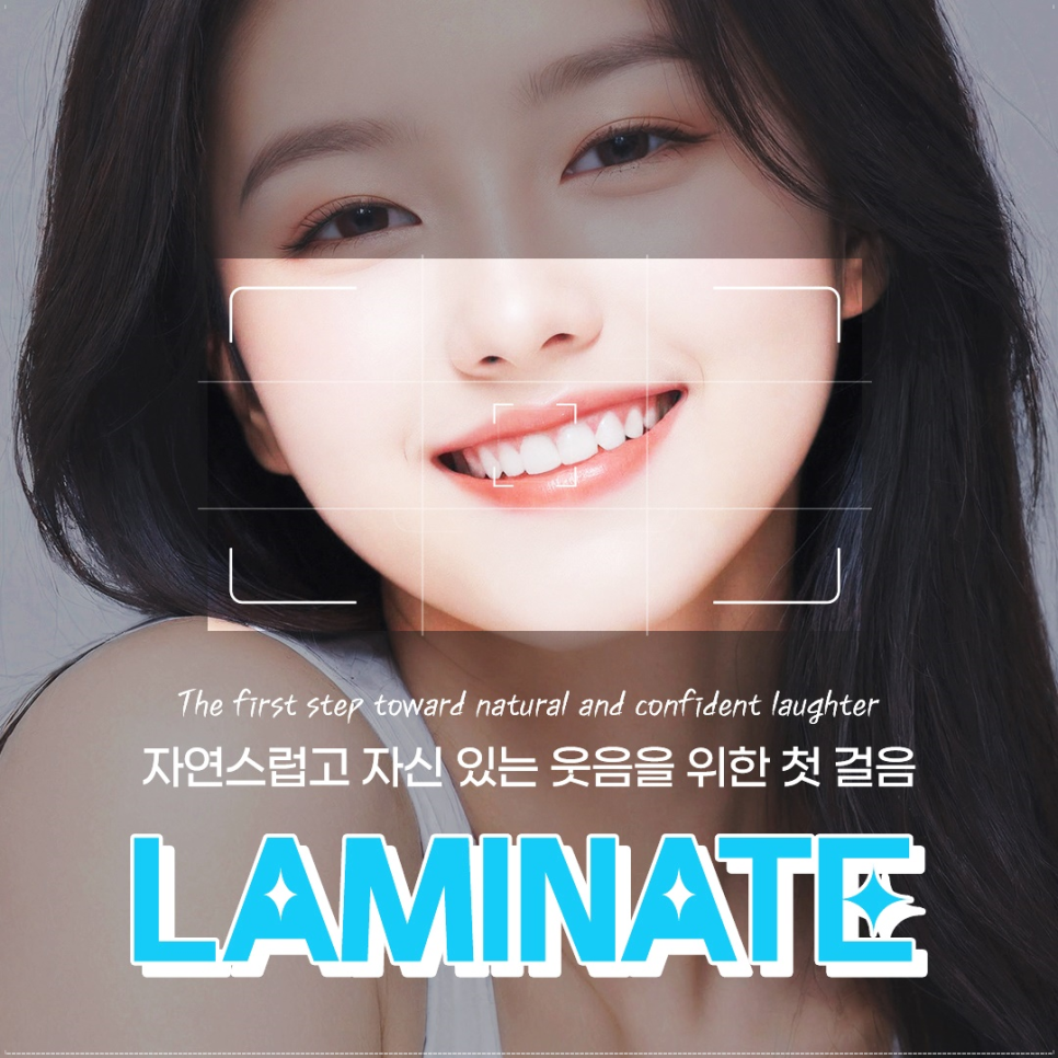 종각치과에서 알려드리는 치아미백과 라미네이트 이후의 달라진 일상 관련 이미지 5