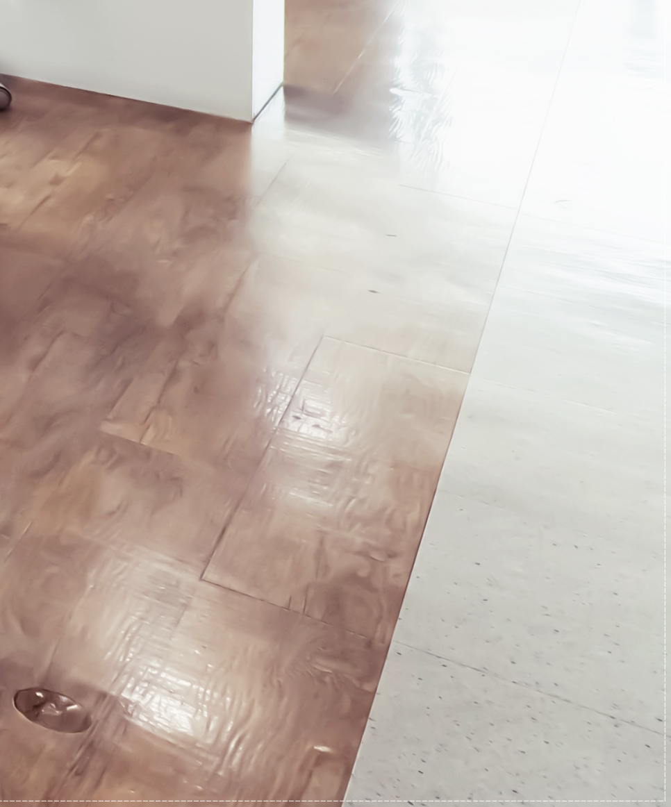 을지로치과 투명해서 티가 안 나게 교정할 수 있어요 관련 이미지 29