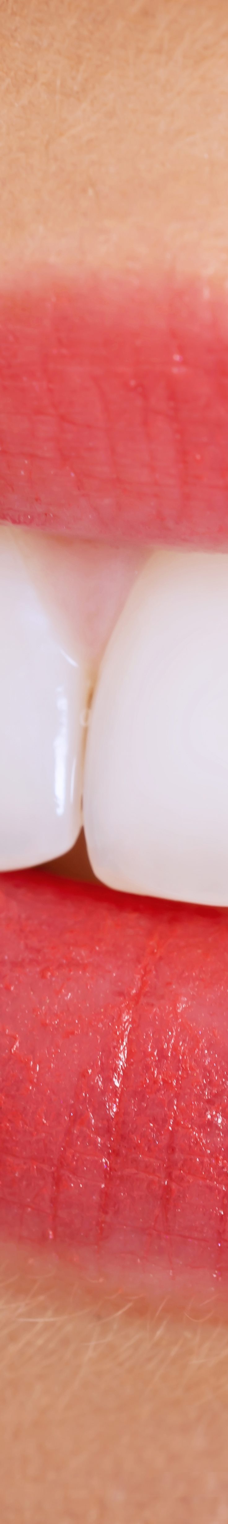 [종각역치과] 치아가 누렇게 보이는 진짜 이유, 미백 전에 꼭 알아야 할 것들 관련 이미지 12