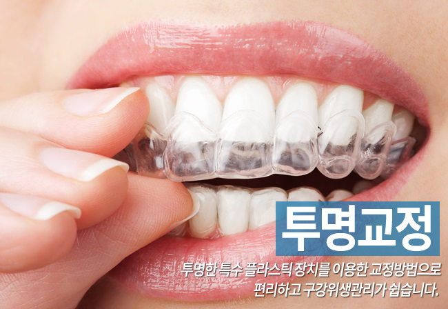 종각역 투명교정 감쪽같이! 관련 이미지 6