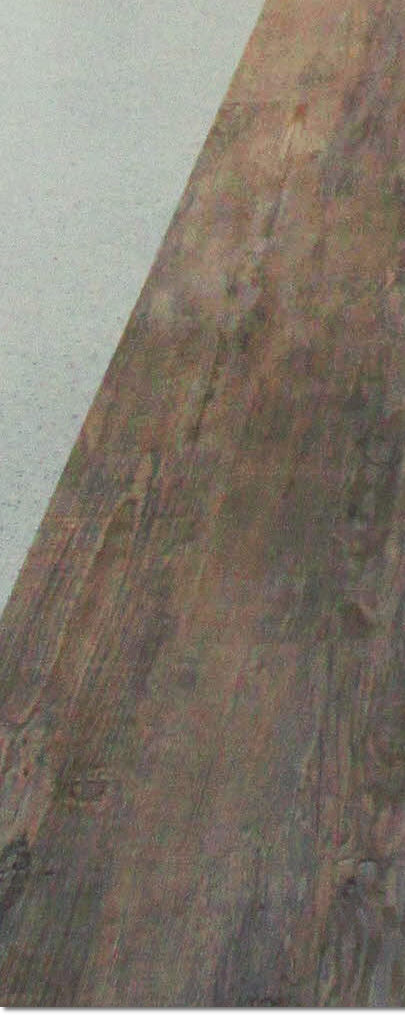 종로구치과 임플란트 하고 끝? 관리까지 잘해줘야 하는 이유 관련 이미지 56