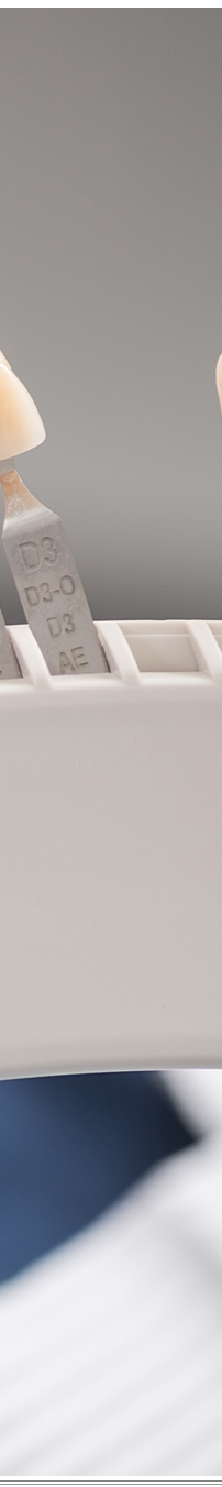 광화문역치과 치아미백과 라미네이트 나에게 필요한 건? 관련 이미지 23