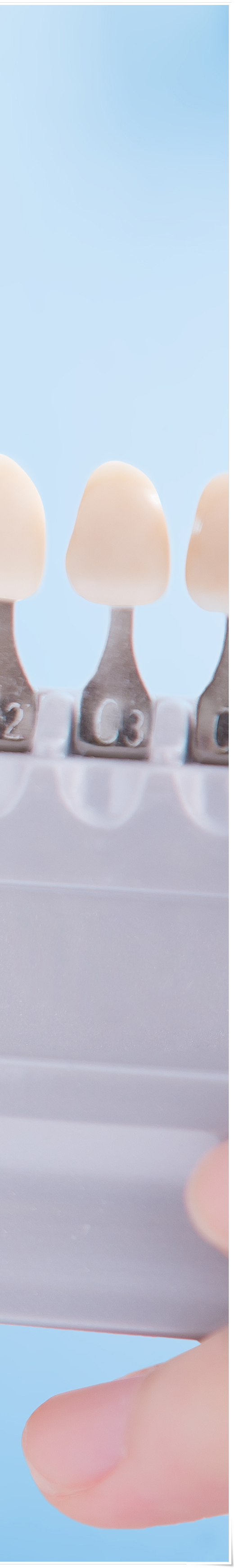 명동치과 라미네이트로 환하게 스마일~ 관련 이미지 18