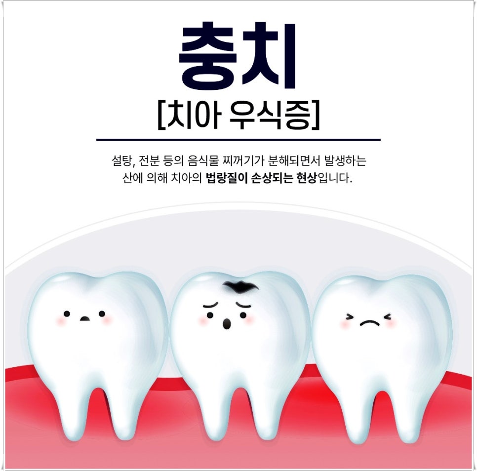 명동치과 치아가 욱씬욱씬 아프신가요? 관련 이미지 2