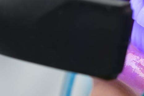 종로치과 치아미백 밝고 환하게 관련 이미지 11