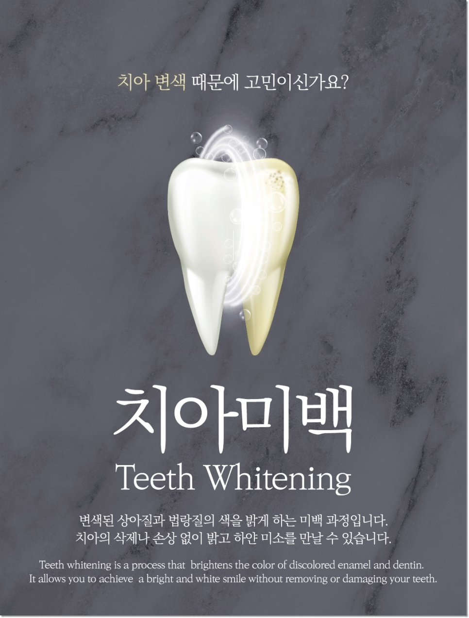 종각치과에서 알려드리는 치아미백과 라미네이트의 숨겨진 비밀 관련 이미지 3