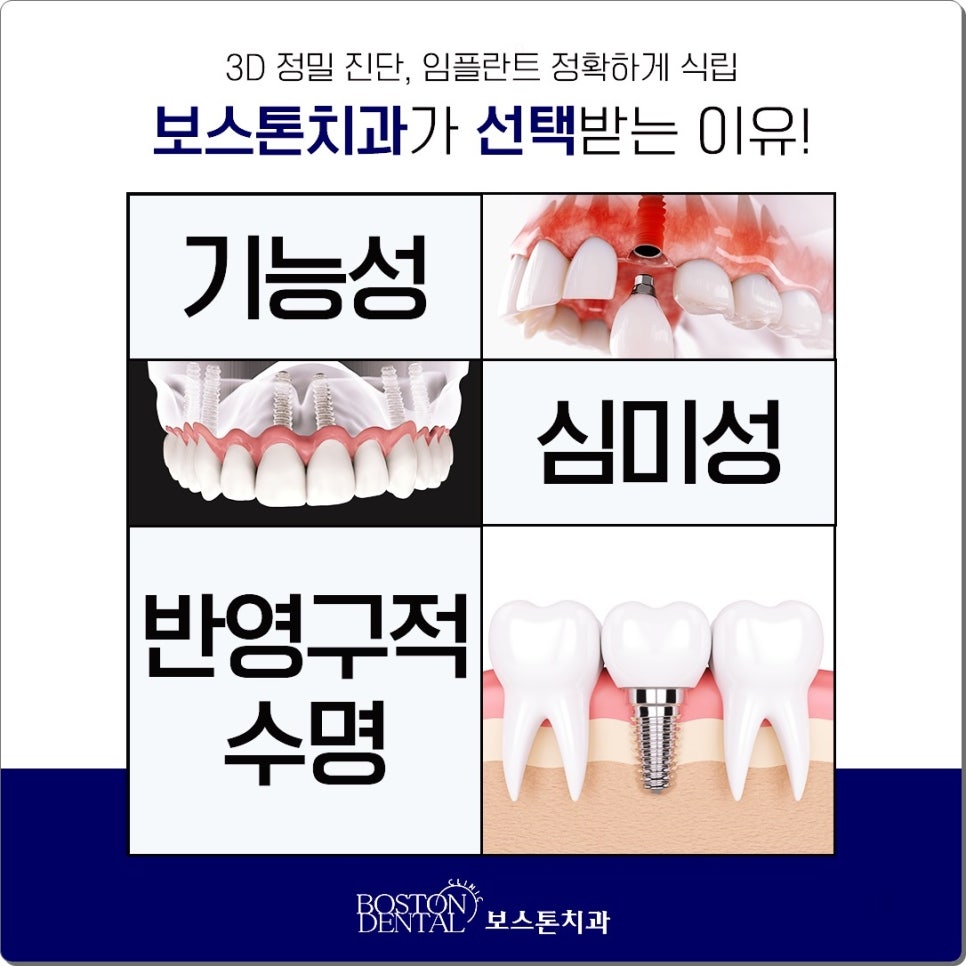 을지로치과에서 야간진료로 누구나 임플란트 치료를 받아요. 관련 이미지 3