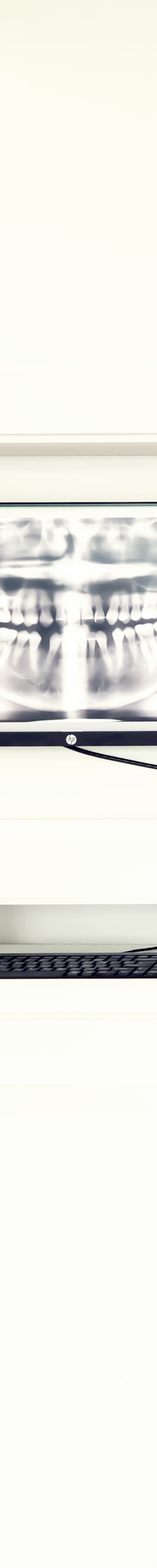 종로치과 수요일 8시까지 야간진료! 관련 이미지 19