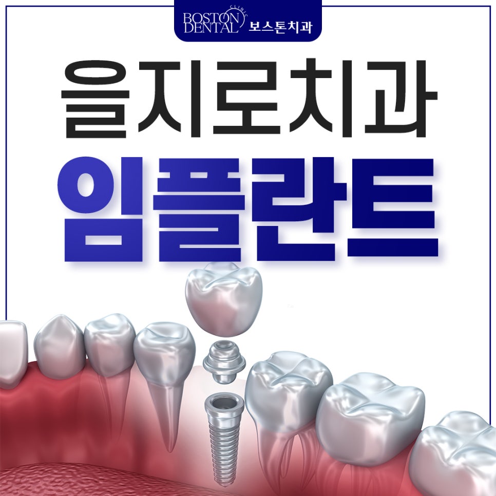 을지로치과에서 야간진료로 누구나 임플란트 치료를 받아요. 관련 이미지 1