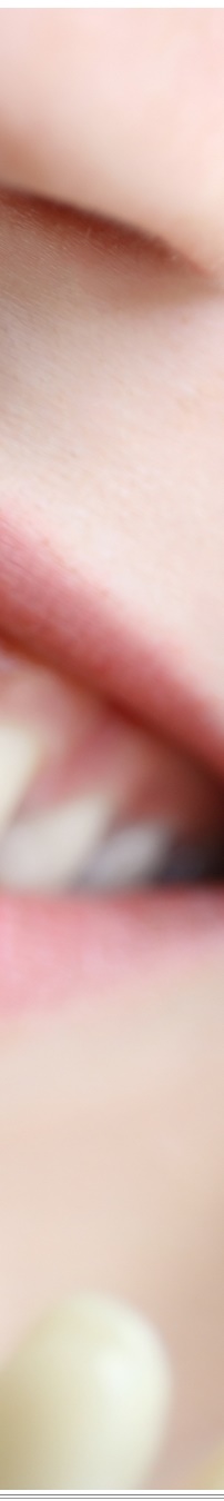 광화문역치과 생활습관에 따른 맞춤형 미백 관리 관련 이미지 33