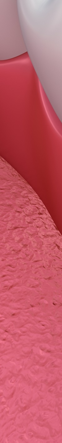 명동치과 주변 치아와 자연스러운 라미네이트 하는 방법 관련 이미지 23