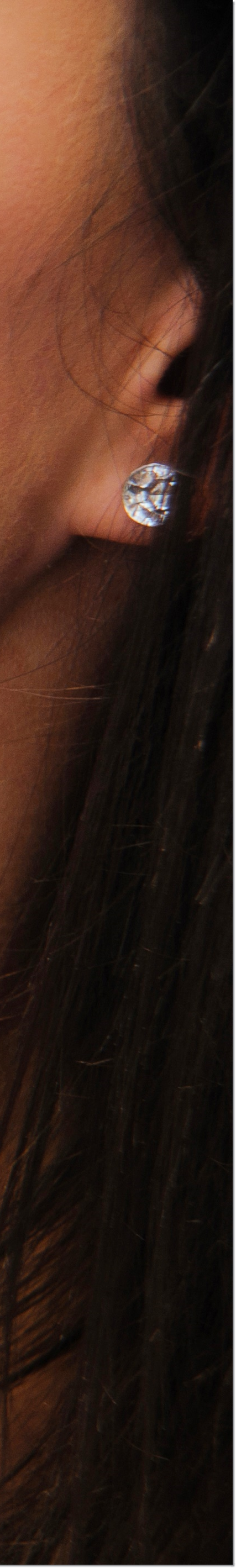 광화문역치과 라미네이트 치료가 궁금해요 관련 이미지 39