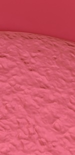 명동역치과 라미네이트 삭제된 치아는 다시 자라지 않습니다. 관련 이미지 35