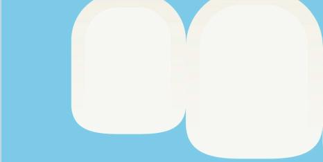 종각치과에서 알려드리는 치아미백과 라미네이트 이후의 달라진 일상 관련 이미지 15