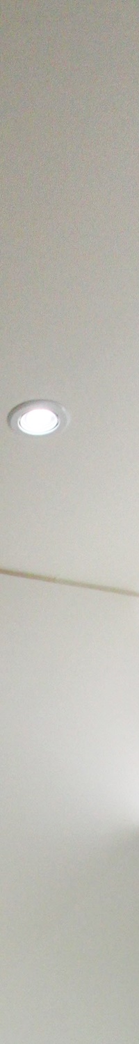 명동역치과 일상생활 중 치아가 흔들린다면 관련 이미지 11