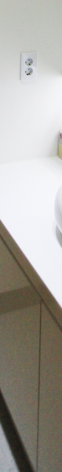 명동역치과 일상생활 중 치아가 흔들린다면 관련 이미지 21