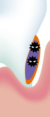 Cavity Treatment, Root Canal Treatment, and Essential Cavity Prevention Tips from a Jongno-gu Dental Clinic! image 22