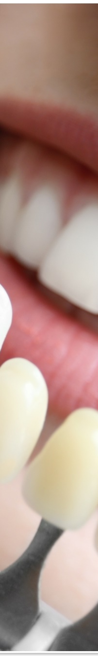 광화문역치과 생활습관에 따른 맞춤형 미백 관리 관련 이미지 30