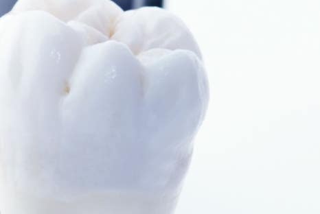 을지로치과 구강검진 잘 받고 계신가요? 관련 이미지 12