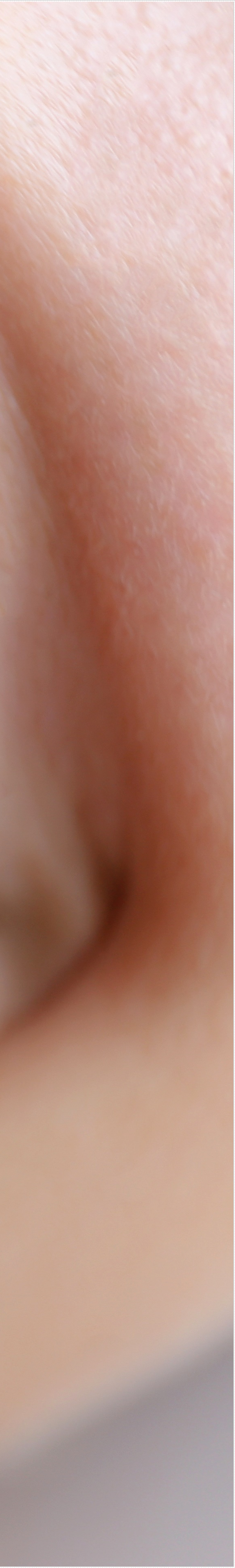 을지로입구역치과에서 알려드리는 치아미백과 라미네이트의 모든 것 관련 이미지 26