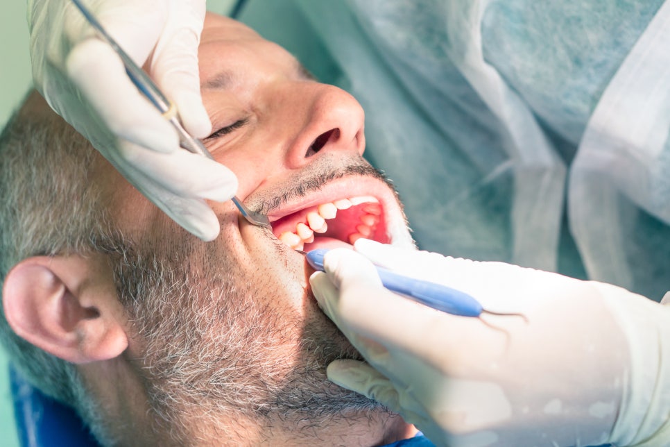 Euljiro Dental Clinic: An Oral Health Care Guide for Busy Office Workers image 6