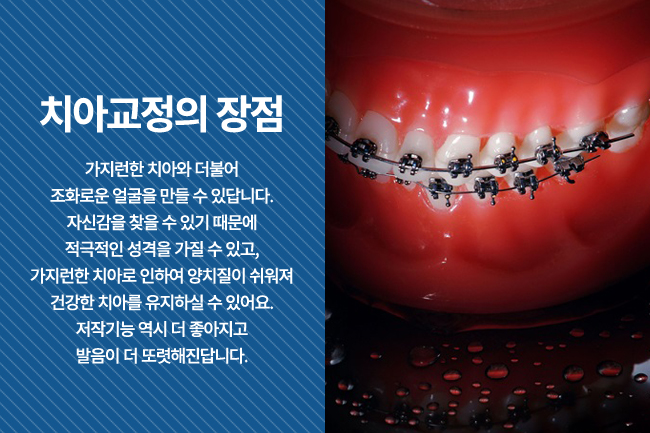 종각역 치아교정 믿을 수 있는 치과 관련 이미지 3