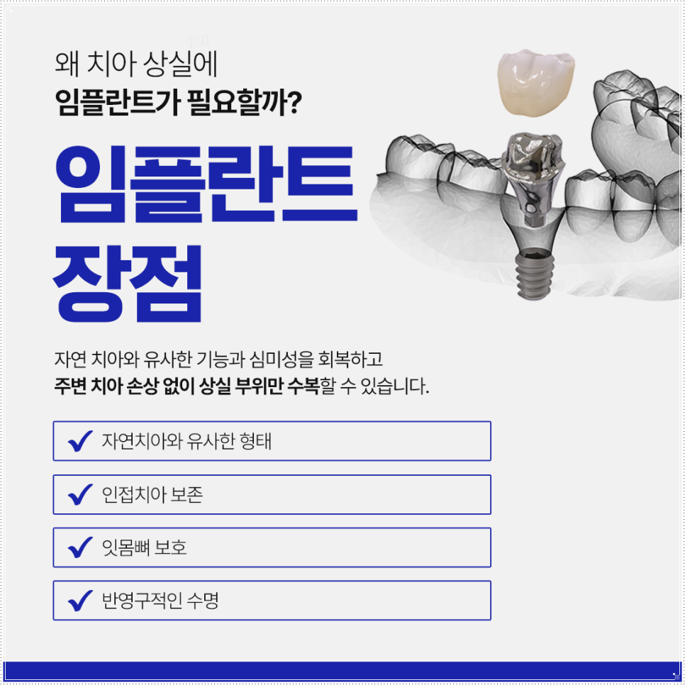 종로치과 왜 임플란트일까? 관련 이미지 1