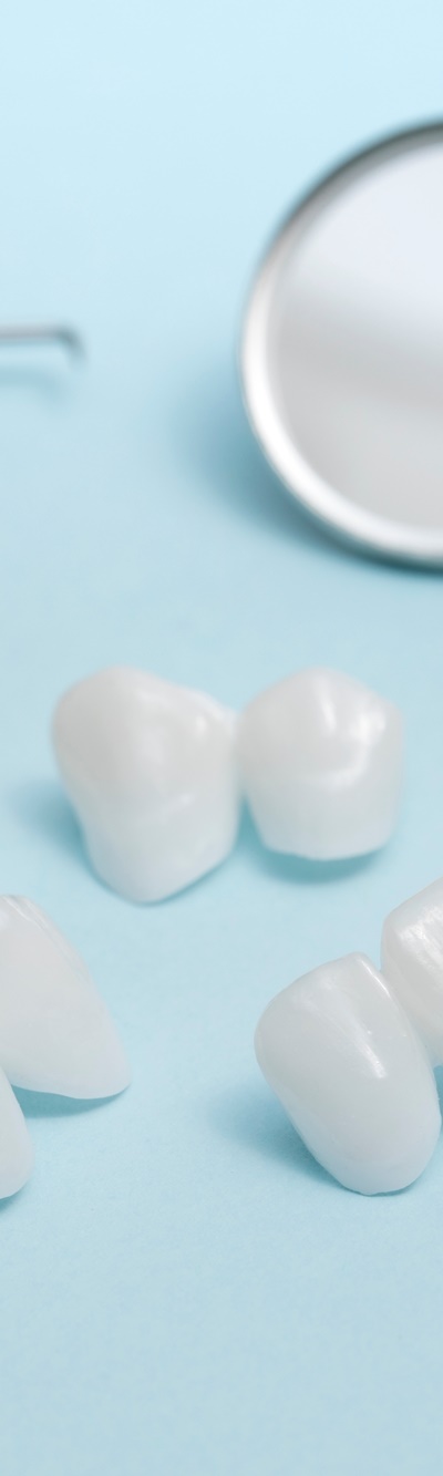 명동치과 주변 치아와 자연스러운 라미네이트 하는 방법 관련 이미지 8