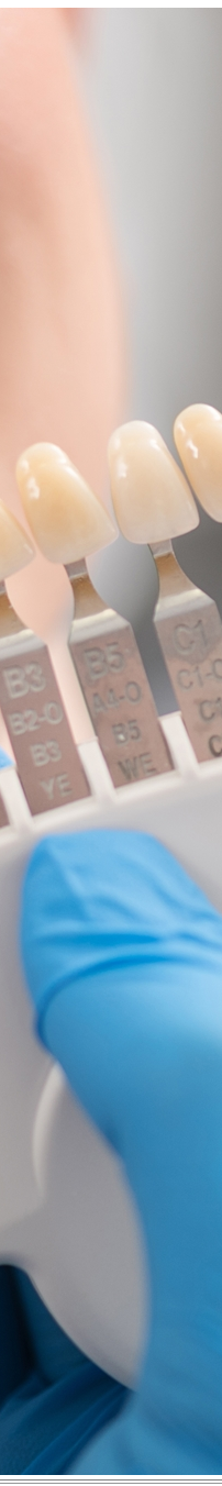 광화문역치과 치아미백과 라미네이트 나에게 필요한 건? 관련 이미지 20