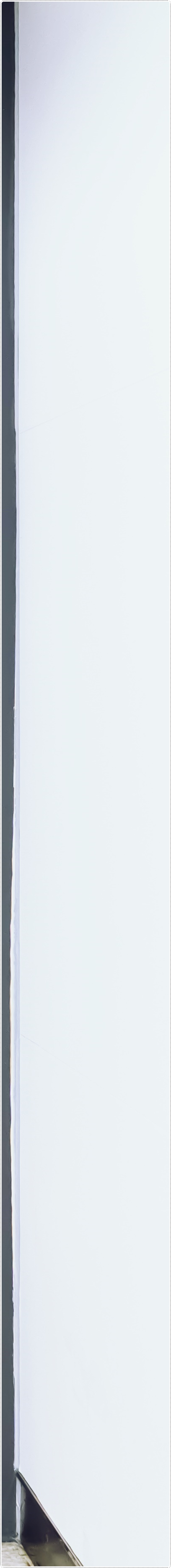 을지로입구역치과 정성을 들이는 치료 관련 이미지 13