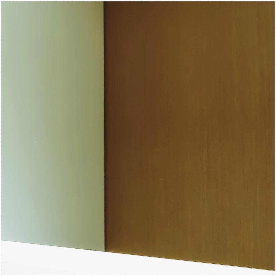 명동치과 임플란트 하기 전 알아두면 좋은 정보 관련 이미지 13