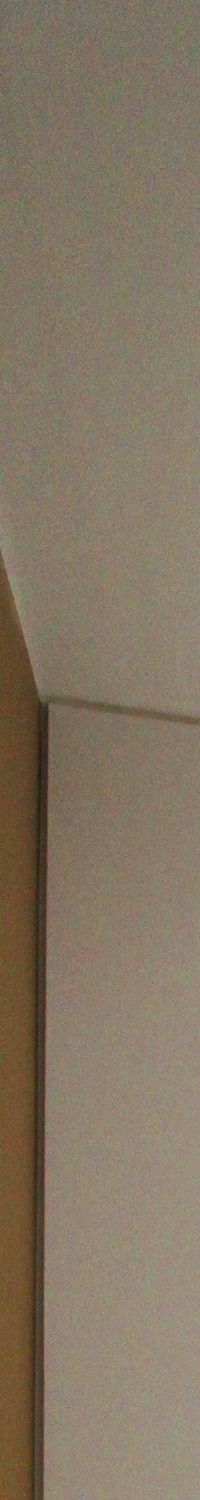 명동역치과 일상생활 중 치아가 흔들린다면 관련 이미지 7