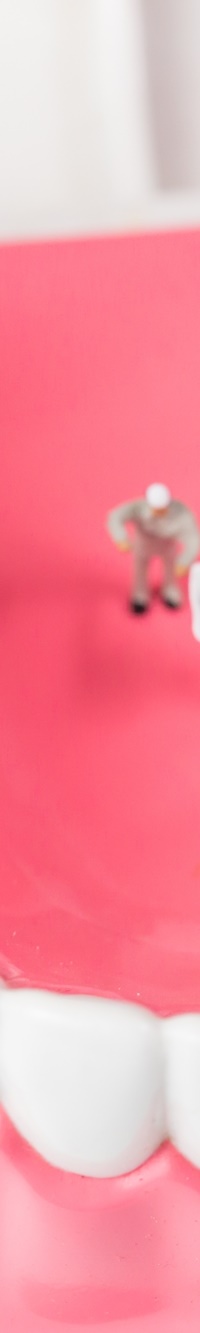 종각역치과 자연치아를 살리기 위한 대책, 신경치료 관련 이미지 22