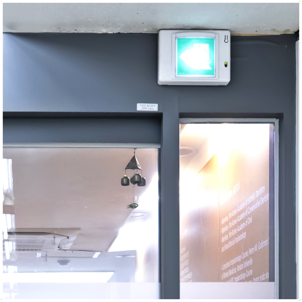 종로치과 마무리까지 확실하게 관련 이미지 37