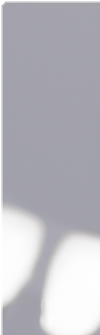 종로치과 라미네이트 주변 치아를 확인하여 자연스럽게 관련 이미지 7