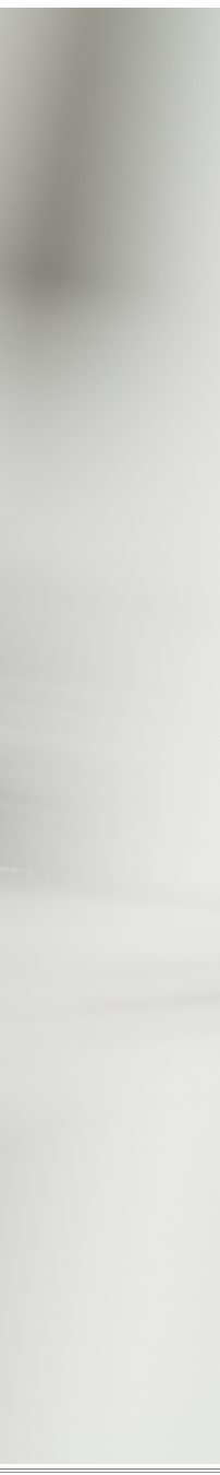 광화문역치과 치아미백과 라미네이트 나에게 필요한 건? 관련 이미지 26