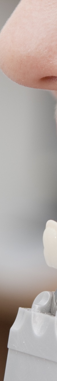 종로치과 자연스러운 라미네이트 색, 얼마나 하얘야 예쁠까? 관련 이미지 10