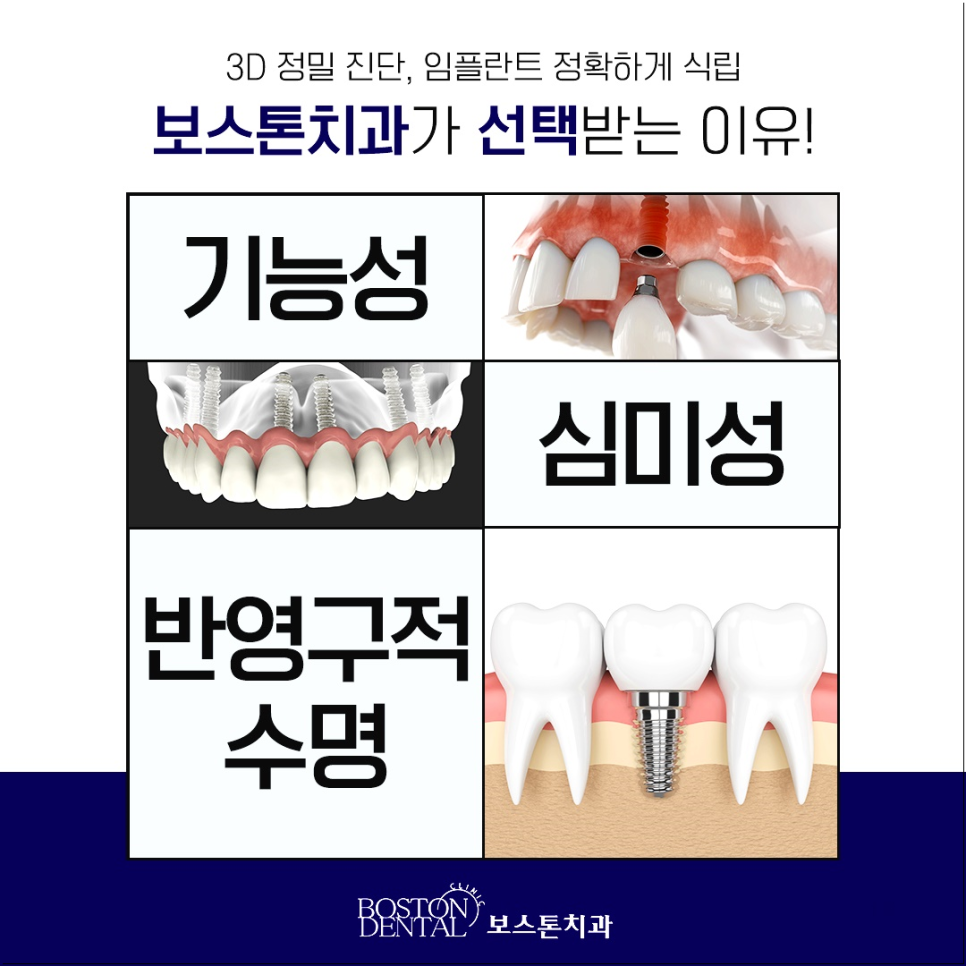 을지로치과 임플란트, 치아가 빠졌다면 어떻게 해야 할까요? 관련 이미지 8