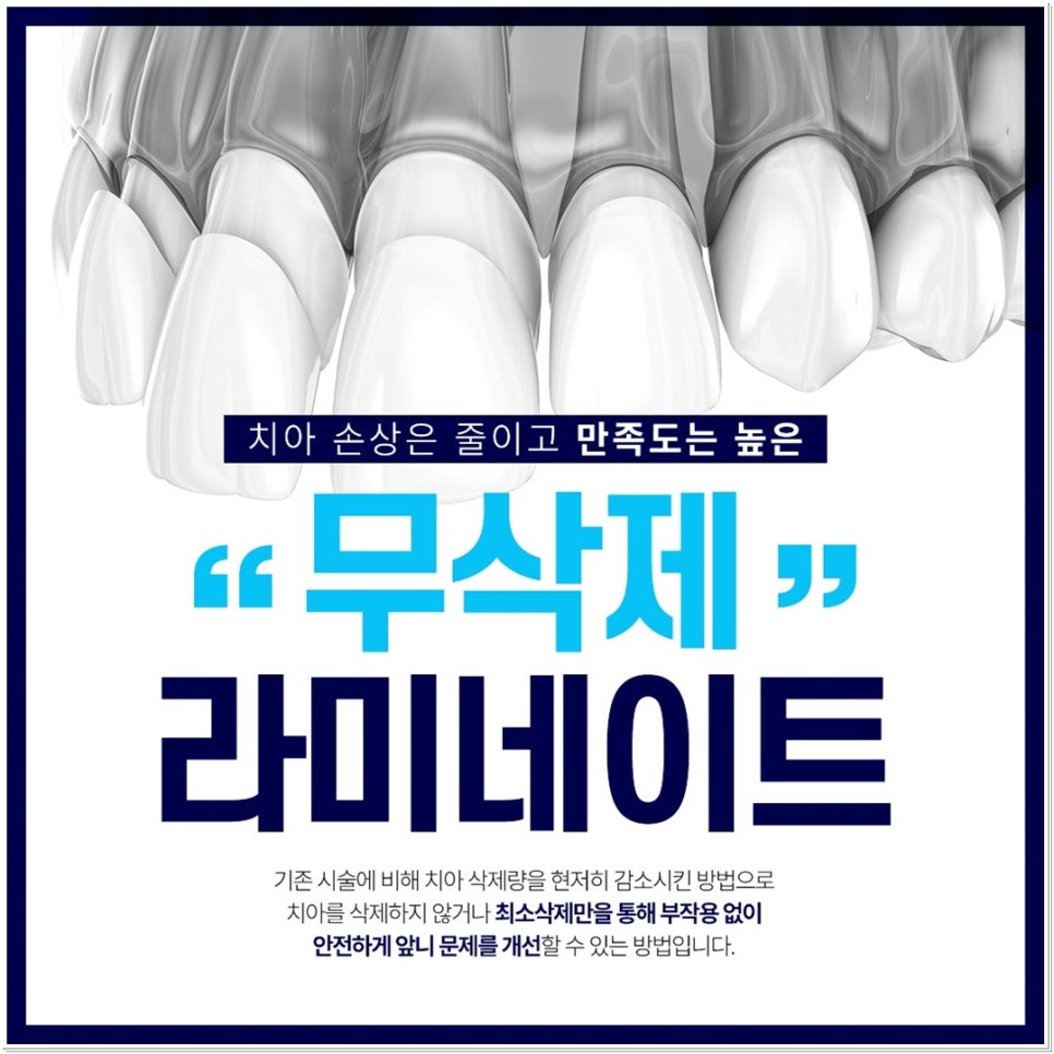 치아 변색 고민 끝, 을지로치과에서 듣는 라미네이트 사례 관련 이미지 4