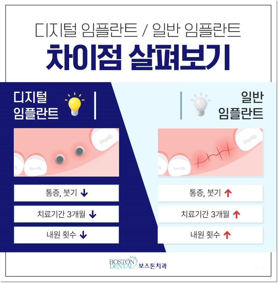 종로치과추천 상실한 치아를 방치하면 생기는 문제점 관련 이미지 7