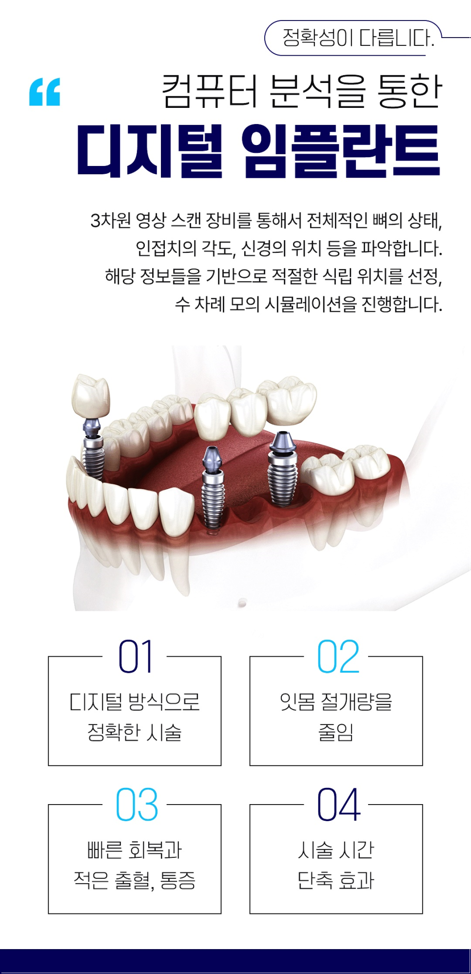 종로임플란트 건강한 치아를 위한 현명한 선택 관련 이미지 4