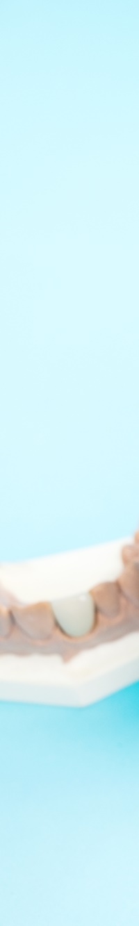 종각역치과 자연치아를 살리기 위한 대책, 신경치료 관련 이미지 27