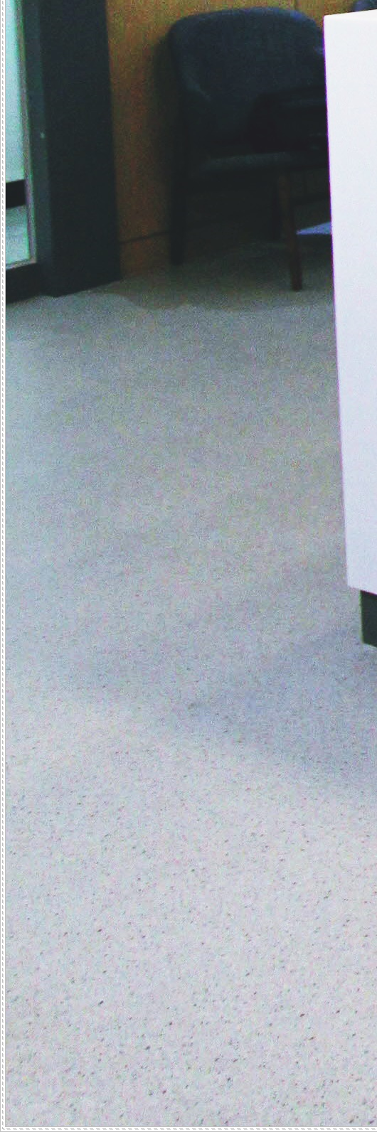 을지로입구역치과 잘 마무리하기 위해서는 관련 이미지 36