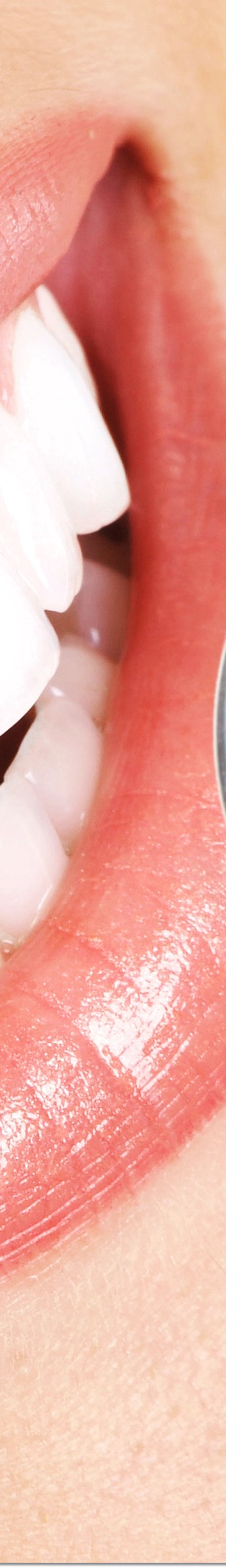 광화문역치과 라미네이트 치료가 궁금해요 관련 이미지 25