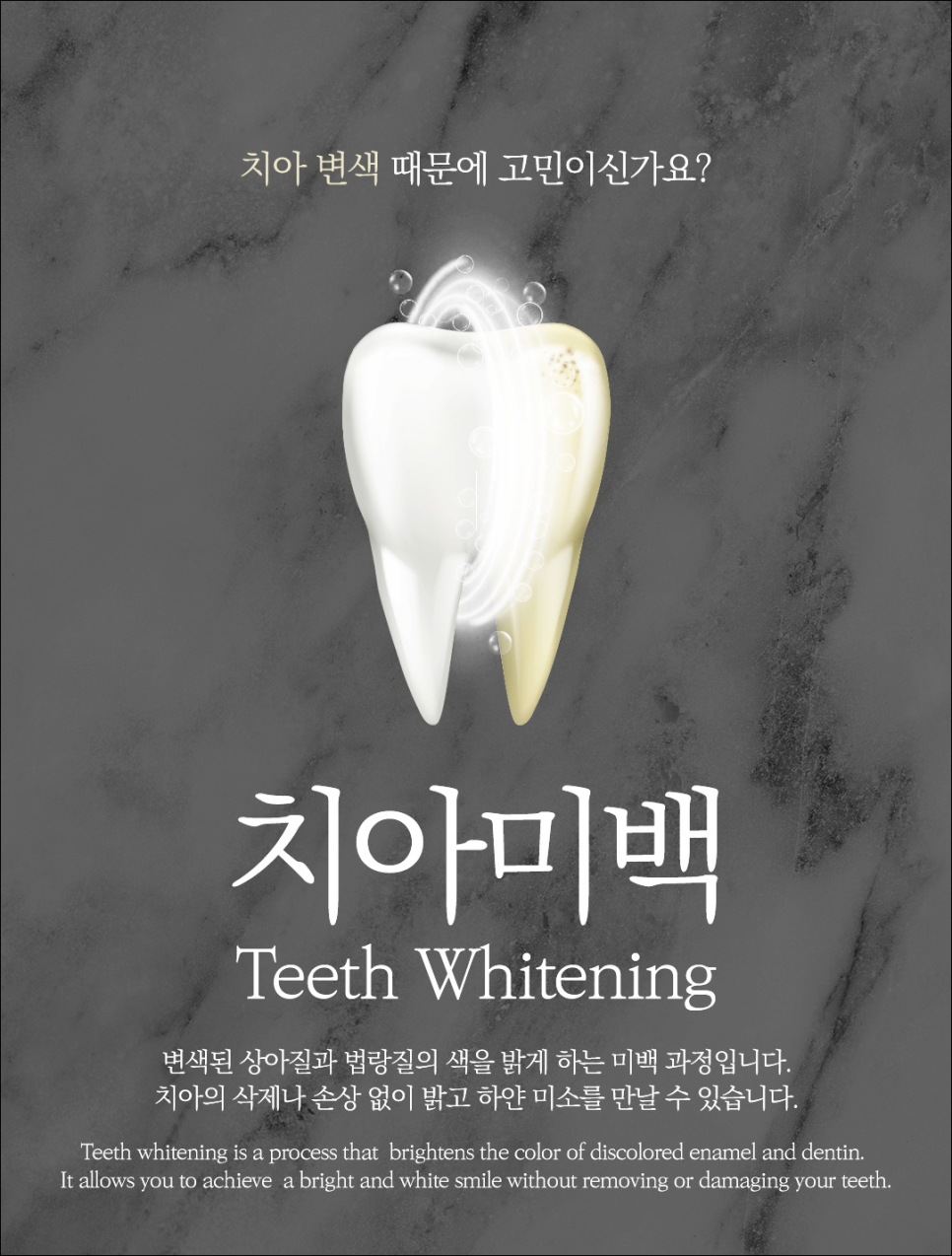 명동치과에서 알아보는 치아미백의 모든 것 관련 이미지 1