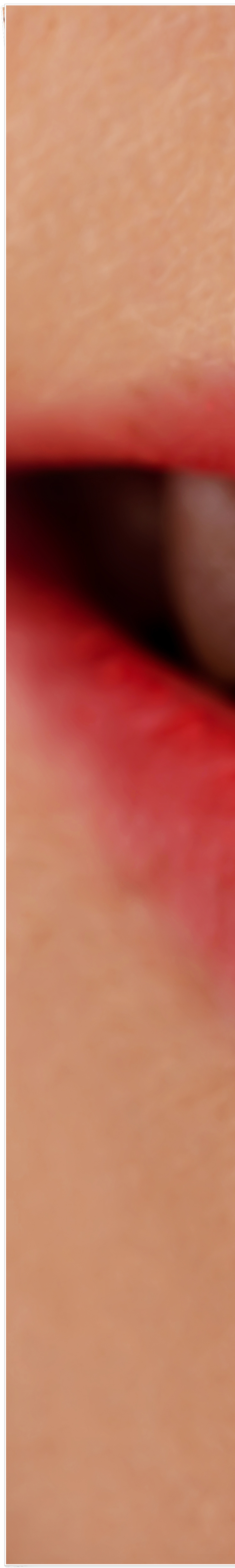 종로3가치과에서 알려드리는 무삭제 라미네이트 완벽 가이드 관련 이미지 10