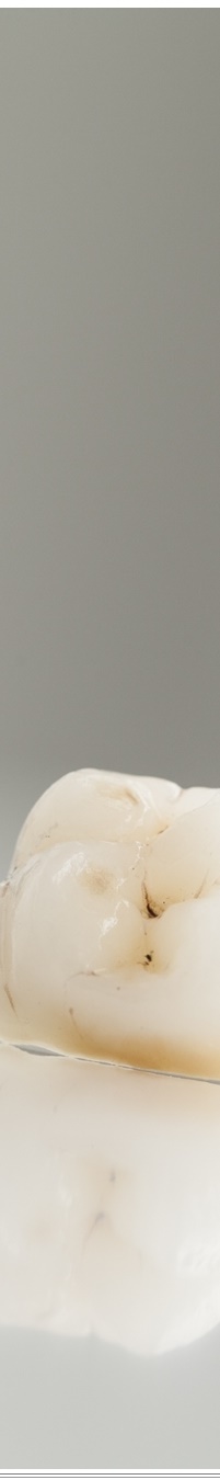 광화문역치과 생활습관에 따른 맞춤형 미백 관리 관련 이미지 12